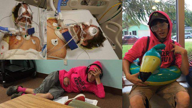 15-year-old loses part of leg, multiple fingers when self-made firework bomb blows up