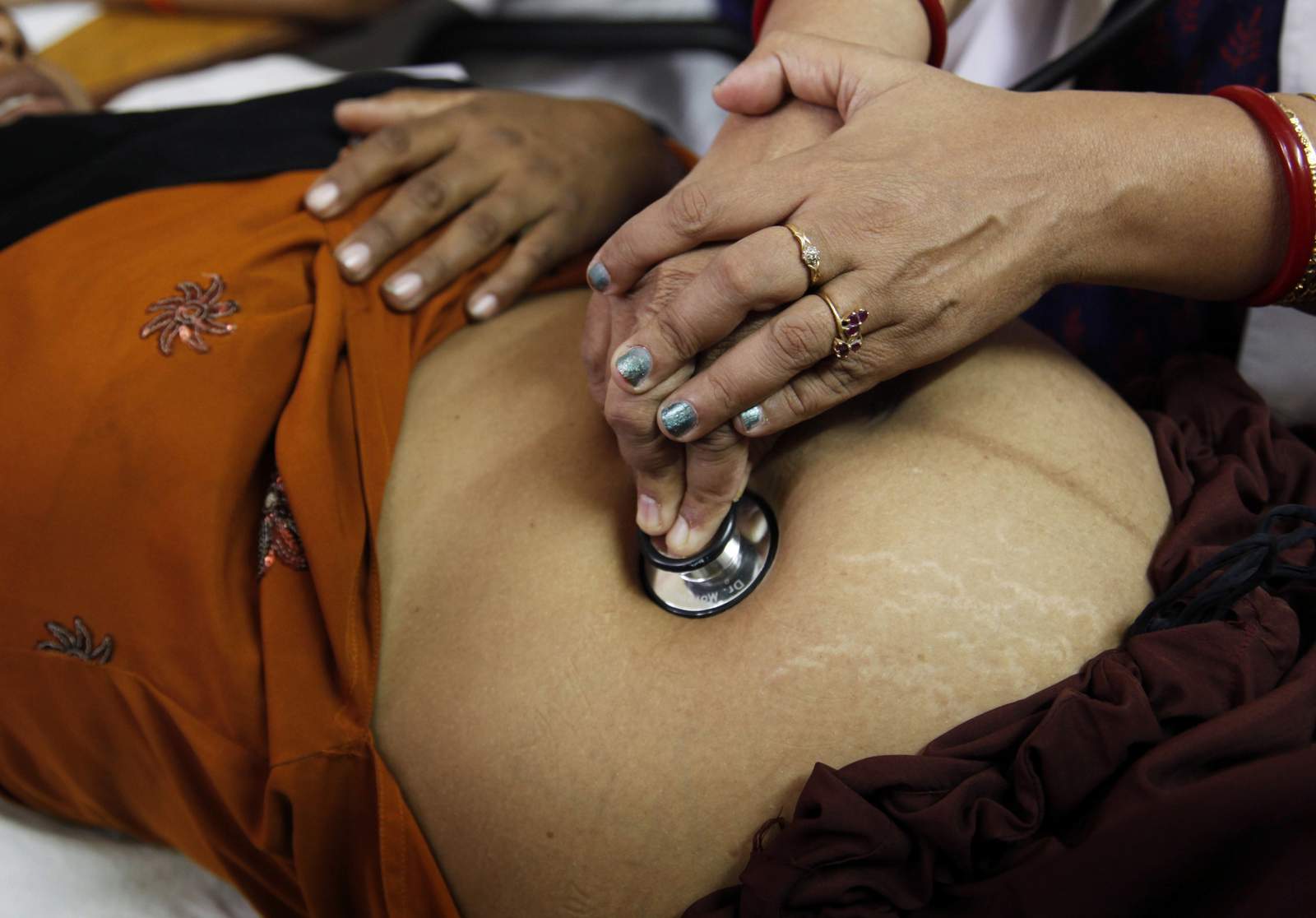 2 million stillbirths every year, pandemic might worsen toll