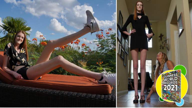 VIDEO: Texas teen breaks Guinness record for world’s longest legs for female, teenager