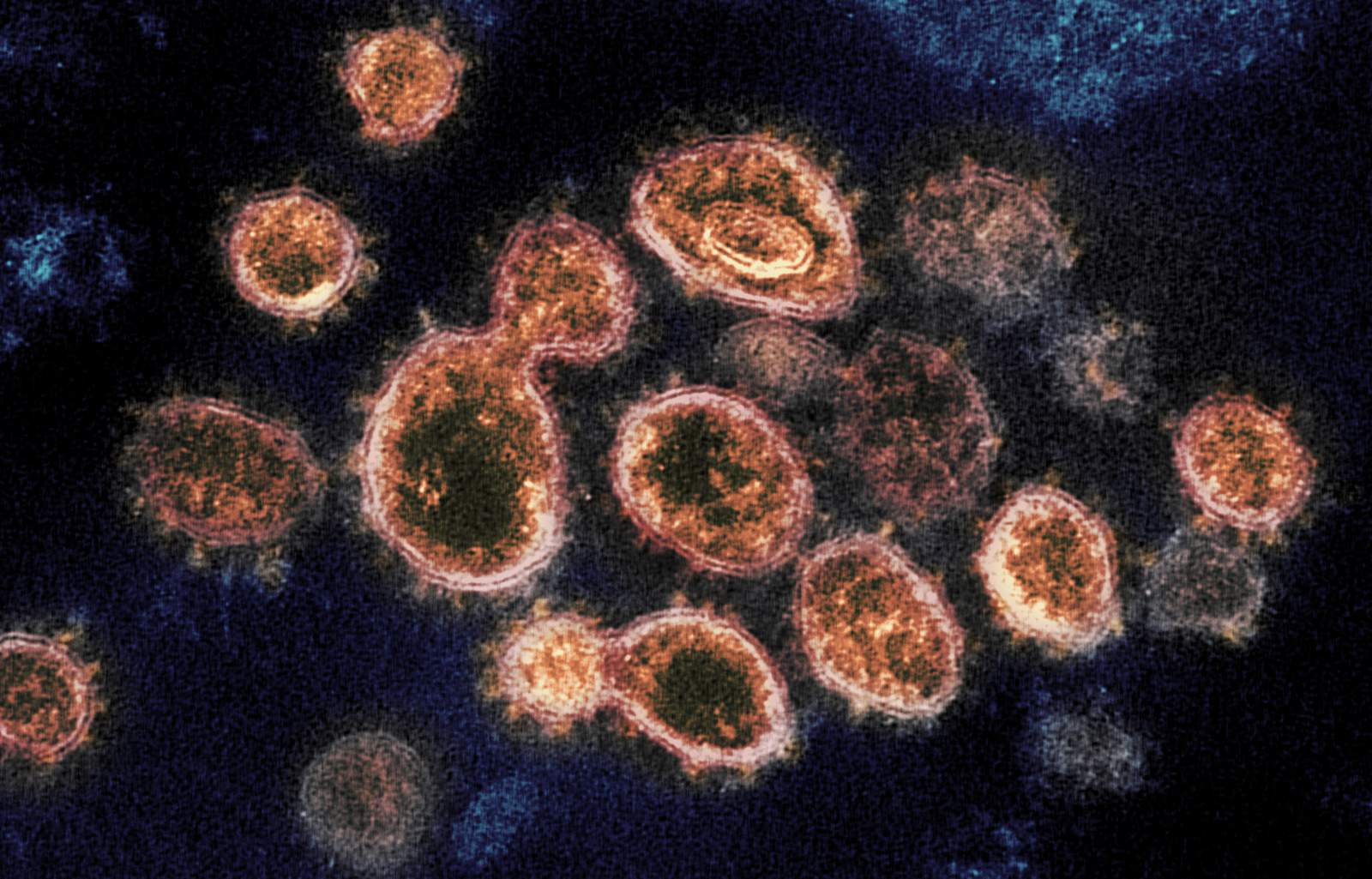 Colorado reports first US case of UK coronavirus variant