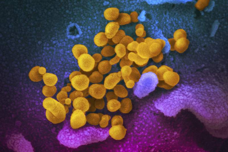 FILE - This undated electron microscope image made available by the U.S. National Institutes of Health in February 2020 shows the Novel Coronavirus SARS-CoV-2, yellow, emerging from the surface of cells, blue/pink, cultured in the lab. The sample was isolated from a patient in the U.S. According to ananalysisby the federal Centers for Disease Control and Preventionpublished Tuesday, April 6, 2021 in JAMA Pediatrics, most children with a serious inflammatory illness linked to the coronavirus had initial COVID-19 infections with no symptoms or only mild ones, new U.S. research shows. (NIAID-RML via AP, File)