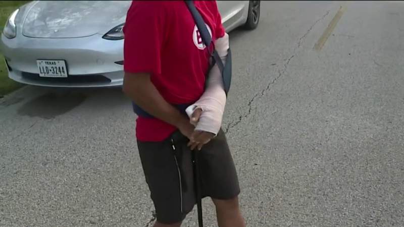 ‘I was left for dead’: Bicyclist recovering after being hit by pickup truck in Fort Bend County