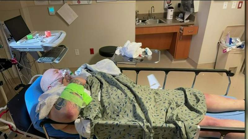 Houston veteran dies of treatable illness after waiting hours for ICU bed