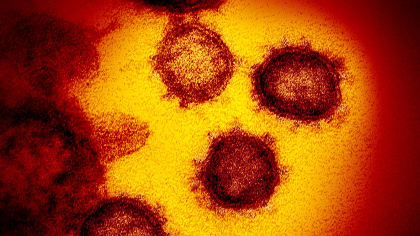 Analysis: Who is getting coronavirus in the Houston area?