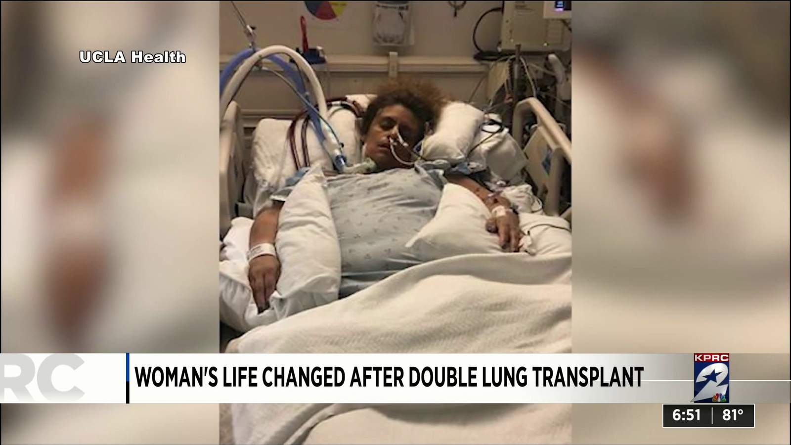 One Good Thing: Womans life changes after double lung transplant