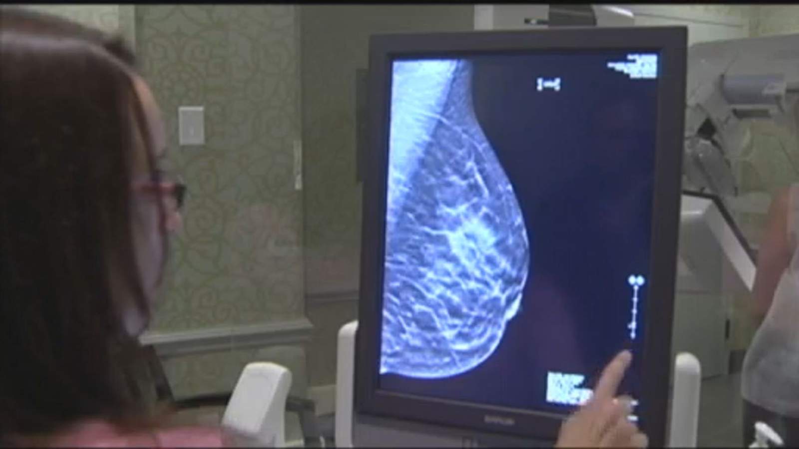 When to begin mammograms, why you shouldn’t use COVID-19 as an excuse to skip them